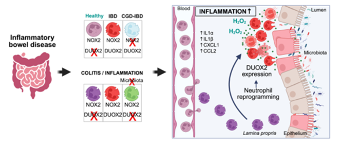 New clue in gut inflammation? 